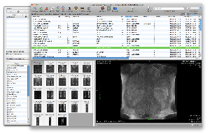 OsiriX for Mac